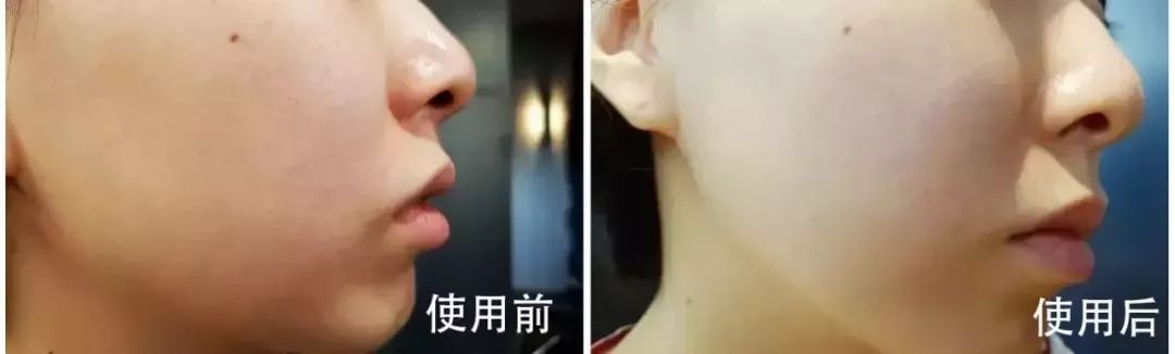 燕窝玻尿酸童颜面膜,玻尿酸燕窝面膜