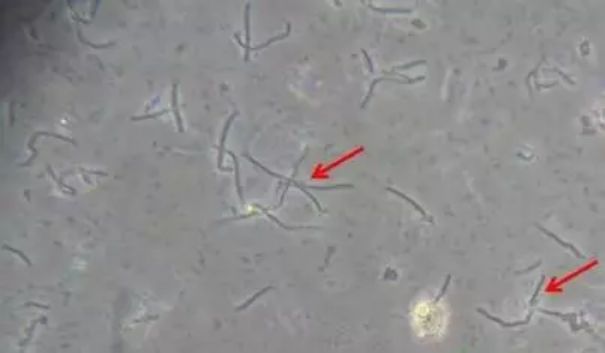 被污染的细胞,污染的细胞怎么处理