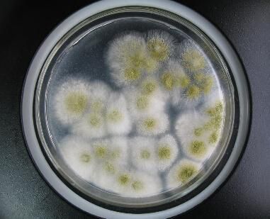 被污染的细胞,污染的细胞怎么处理