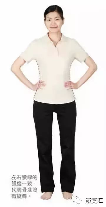 骨盆倾斜能做骨盆修复吗,体态康复骨盆前移