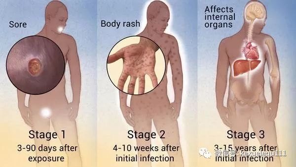 自愿知情承担责任,不伤害原则与尊重原则