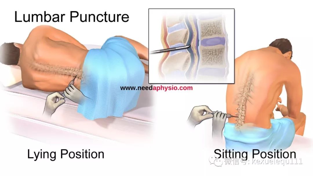 自愿知情承担责任,不伤害原则与尊重原则
