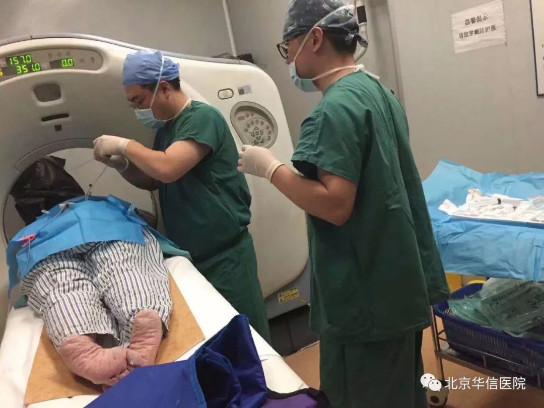 低温等离子微创消融术,北京华信医院麻醉