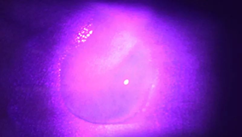 适合黑皮和黄皮的面膜,适合黄皮的mm面膜