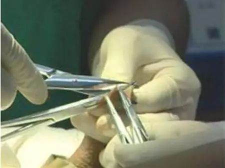 鸡动手术,小鸡仔做绝育手术