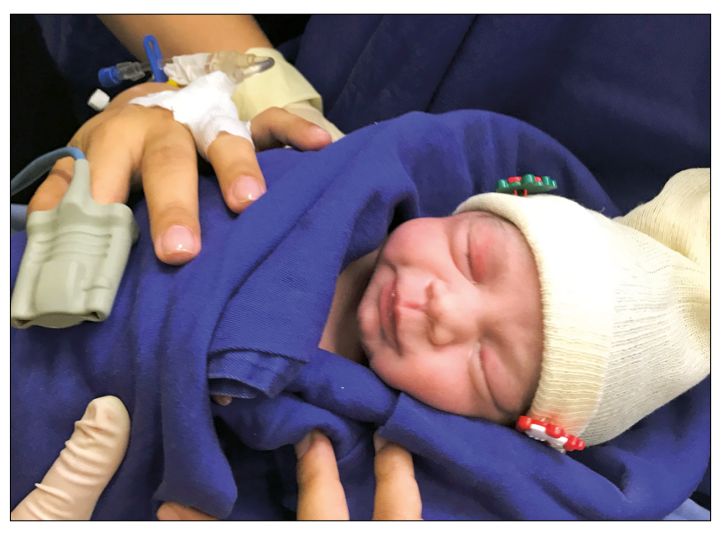 柳叶刀人造子宫,柳叶刀移植