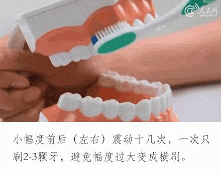 花了一万元做牙齿很难看,花了60万做的牙齿