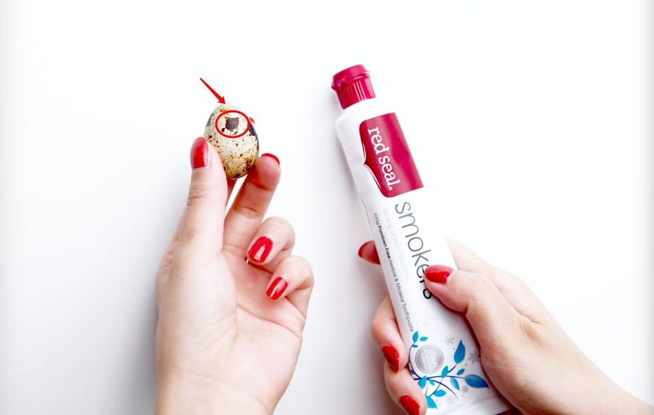 花了一万元做牙齿很难看,花了60万做的牙齿