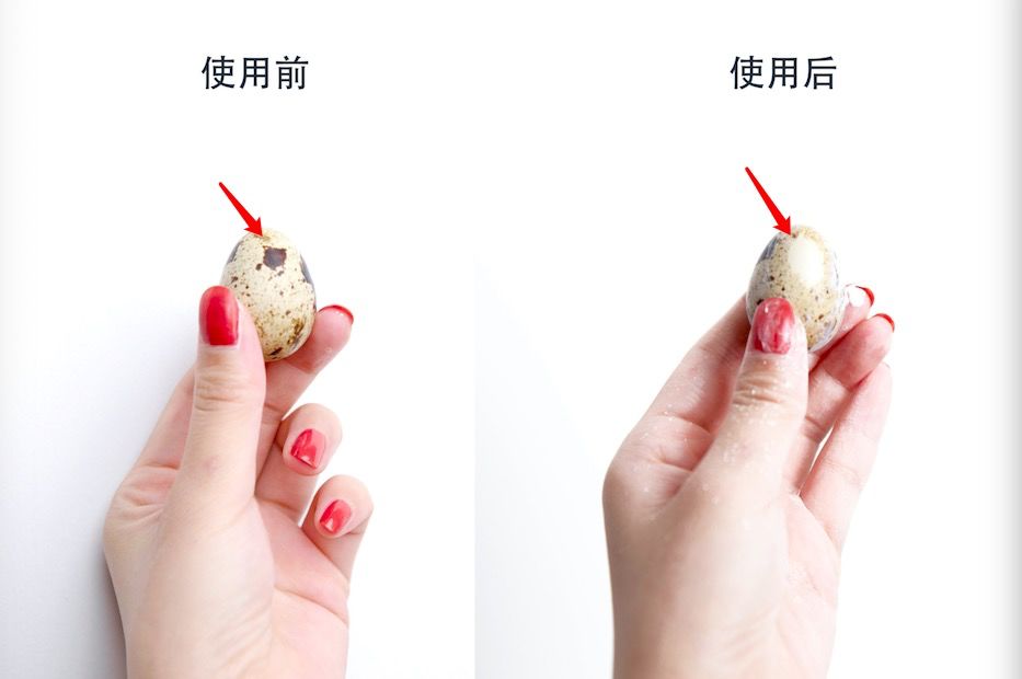 花了一万元做牙齿很难看,花了60万做的牙齿