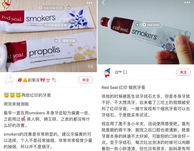 花了一万元做牙齿很难看,花了60万做的牙齿