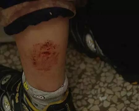 不小心被宠物猫轻微抓伤了,宠物店如何防止被猫狗抓伤咬伤