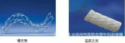 微创介入治疗肿瘤是什么科,介入治疗肿瘤副作用