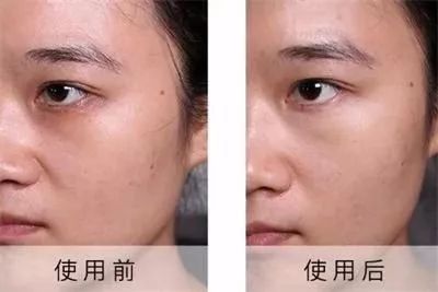 每天眼上敷一片,眼不花看得清,再也不怕近视了,男女老少都爱!