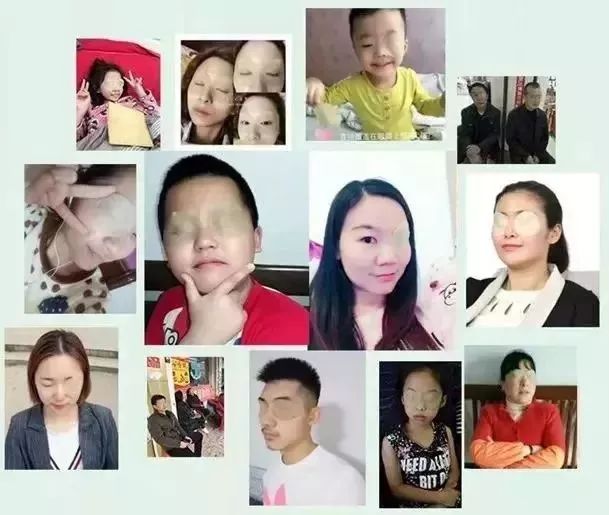 每天眼上敷一片,眼不花看得清,再也不怕近视了,男女老少都爱!