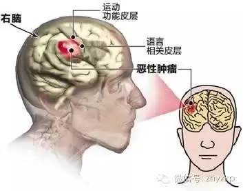 小不忍则乱大谋不可纠缠,小不忍则乱大谋不必理睬