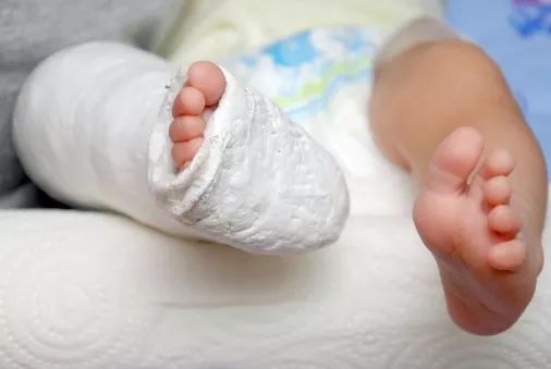 宝宝骨密度低一定是缺钙吗,宝宝骨密度严重不足有何影响