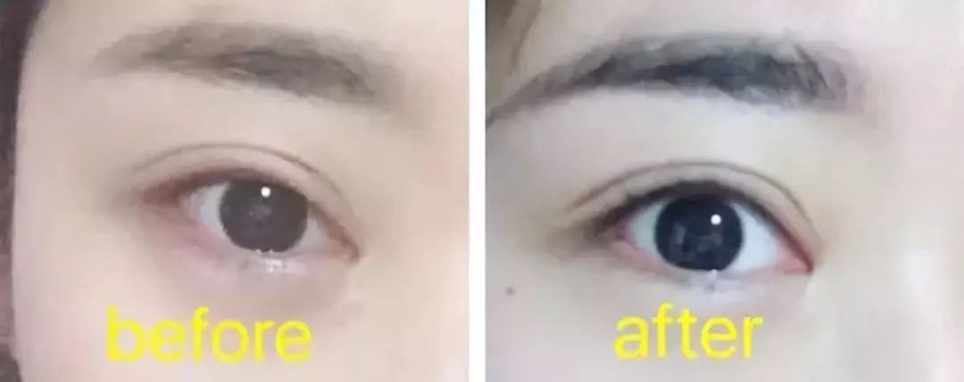 韩国品牌眼霜补水保湿,推荐一款韩国好用的眼霜