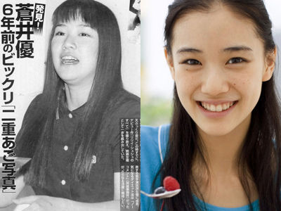 无需抽脂的韩国溶脂仪，2周抚平橘皮，腰围还瘦3cm