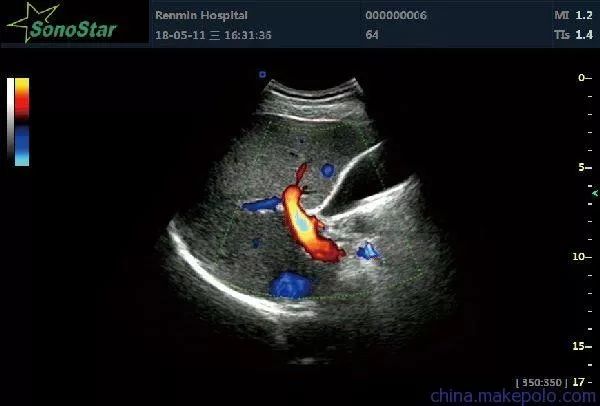 产检B超:能偷看宝宝几次?