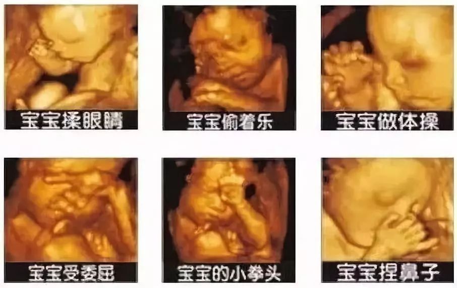 产检B超:能偷看宝宝几次?