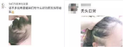 头等大事脱发青年自救指南,秃头女孩必看6大脱发误区
