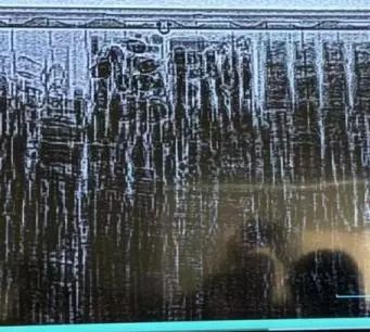 31万件走私代购韩国化妆品被截获,代购化妆品涉案800万怎么判刑