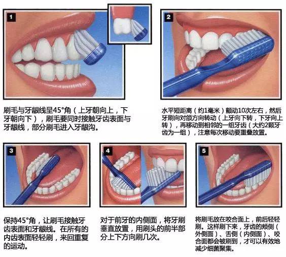 吃东西塞牙而且牙缝还特别臭,吃东西牙缝老塞牙怎么办