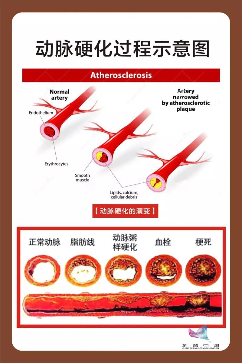 吃盐少摄入盐分不足的危害有哪些,低盐饮食是摄入盐越少越健康吗