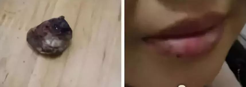 嘴唇干咬嘴唇起皮,嘴唇起皮干裂能不能咬嘴唇