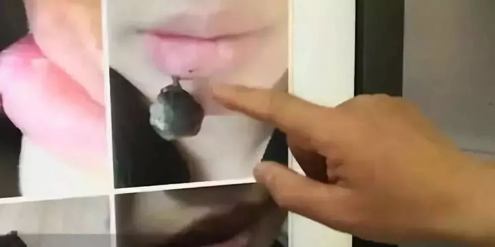 嘴唇起皮干裂能不能咬嘴唇,嘴唇起皮用手撕开了怎么办