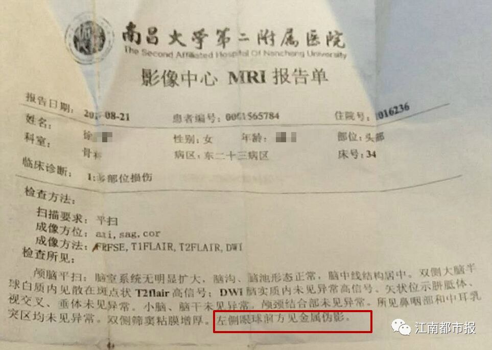 双眼皮手术后迎风流泪是什么原因,女子割完双眼皮眼睛却睁不开了