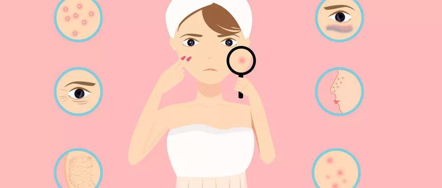 黑头挤完怎么处理,挤完黑头抹什么