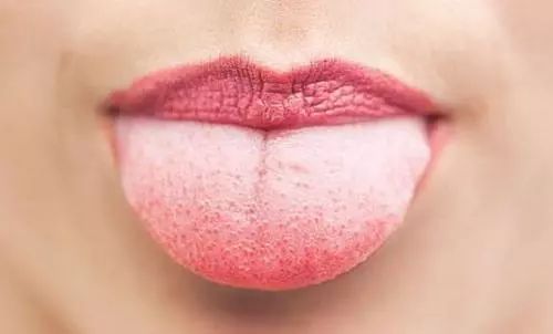 健康｜舌象：随身携带的“体检报告”