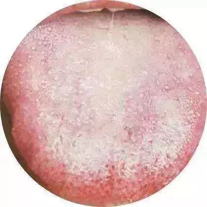 健康｜舌象：随身携带的“体检报告”