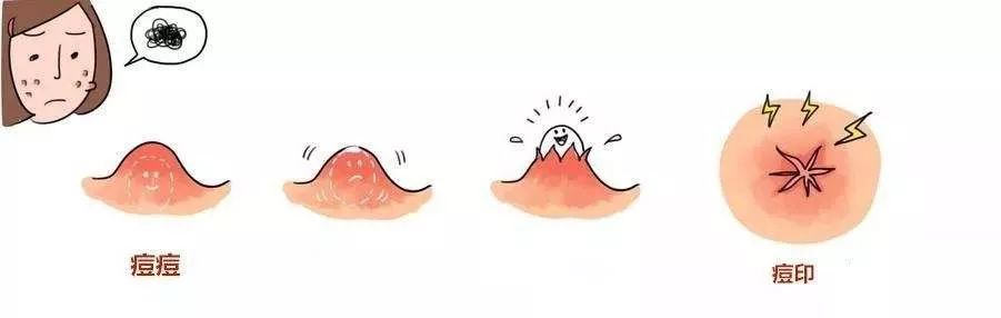 额头闭口留下痘印怎么解决,痘印泛红怎么解决