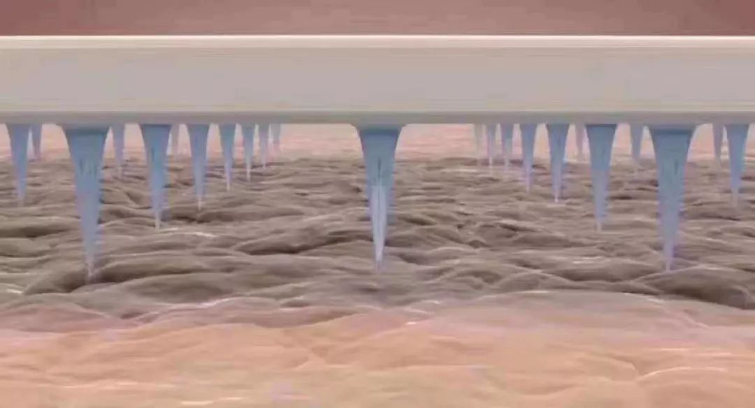 额头闭口留下痘印怎么解决,痘印泛红怎么解决