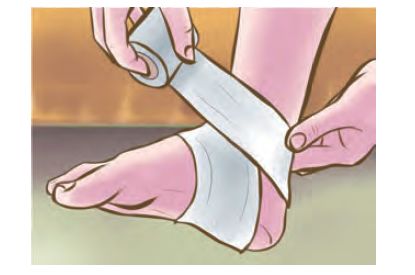 跑步崴脚怎么康复训练图片,跑步崴脚了怎么在家锻炼