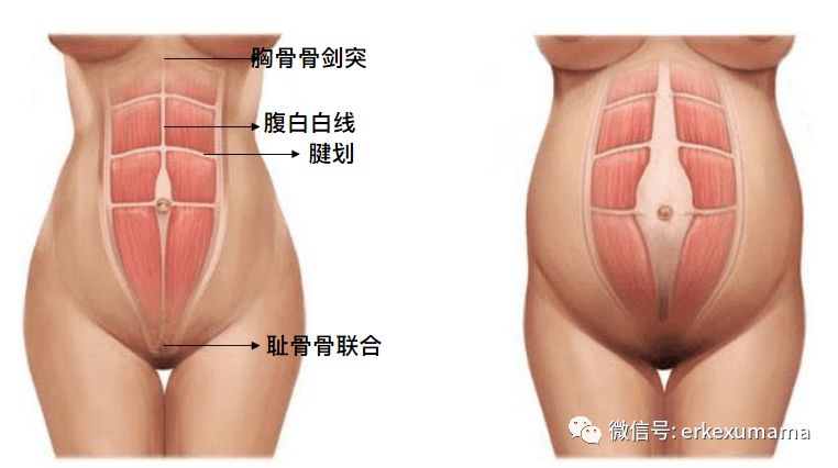 母乳喂养期间怎么瘦肚,世界公认瘦肚子最快最有效的方法