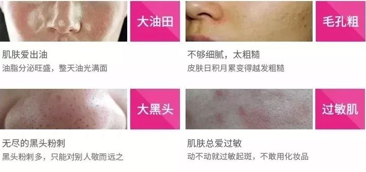 luna平价替代品,平价版的luna