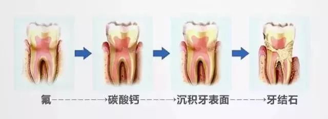 牙龈出血抗敏感牙膏,牙博士牙龈出血专用牙膏