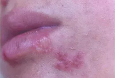 杏林医院皮肤科,杏林皮肤科医院