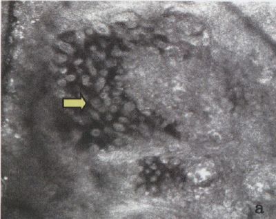 杏林医院皮肤科,杏林皮肤科医院