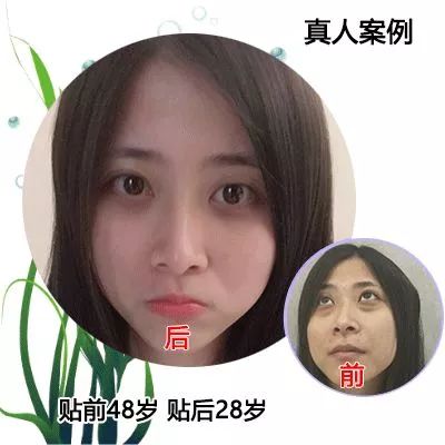 50岁没有眼袋眼纹黑眼圈,60岁去眼袋的最佳方法