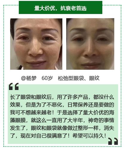 50岁没有眼袋眼纹黑眼圈,60岁去眼袋的最佳方法