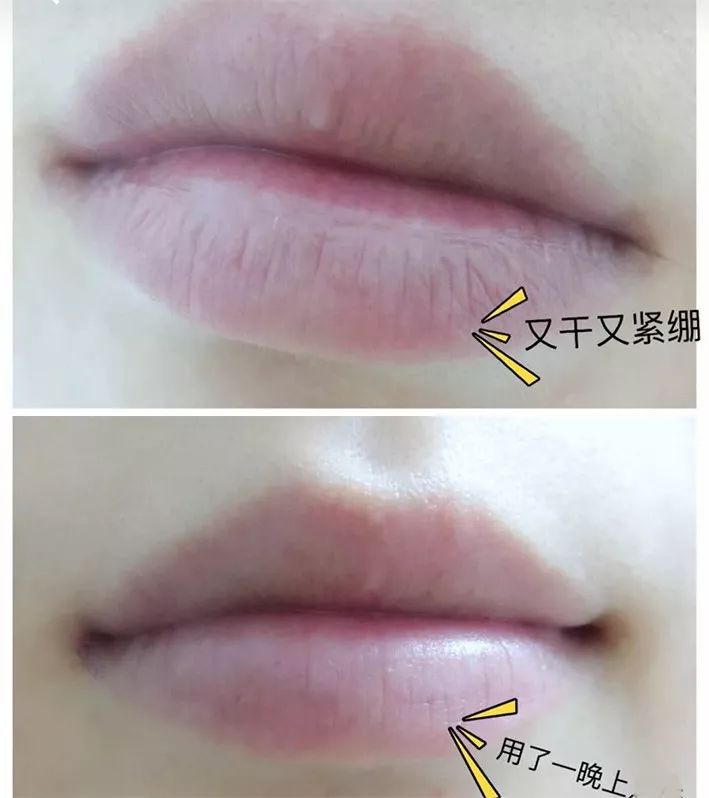 唇膜贴干唇救星,唇干裂用什么护唇