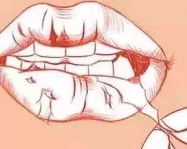 嘴唇干裂脱皮唇炎灌脓怎么办,嘴唇干裂起皮痒是哪种唇炎