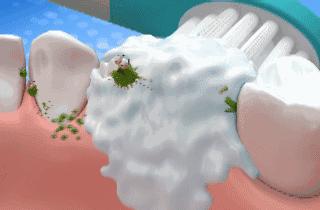 牙齿太黄简单的方法不用花钱,牙齿黄除了洗牙还有什么办法