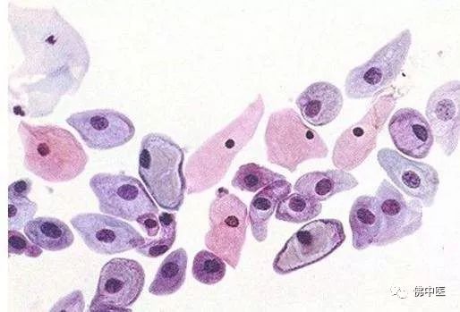 「关注」九价疫苗以外,防治HPV感染还需注意这些……