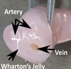 你猜得到吗，肚脐眼原来连着这些地方