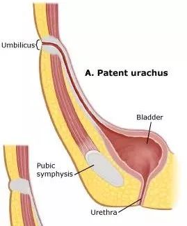 你猜得到吗，肚脐眼原来连着这些地方